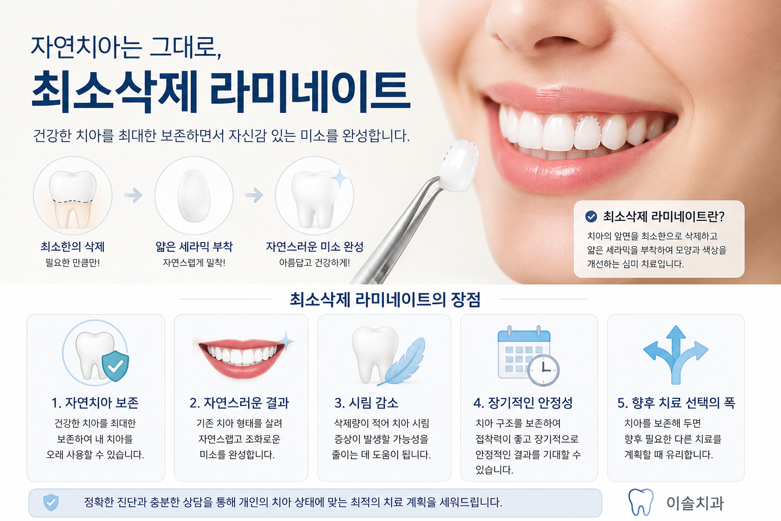 라미네이트가 망설여진다면? 최소삭제 라미네이트를 알아보세요