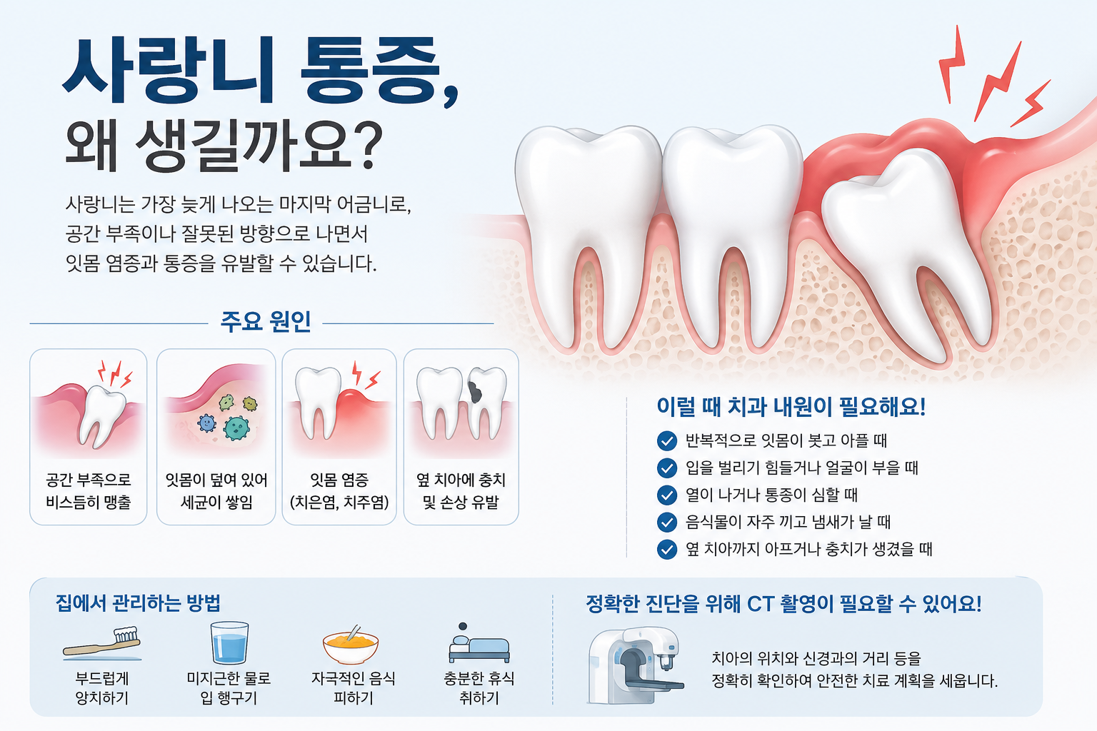 사랑니발치에 관한 설명