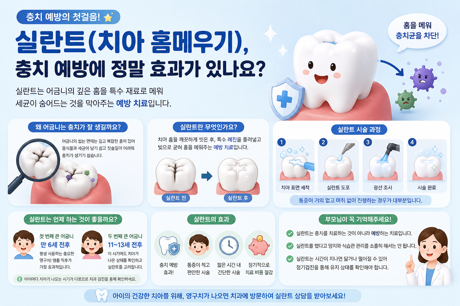 실란트(치아 홈메우기), 충치 예방에 정말 효과가 있나요?