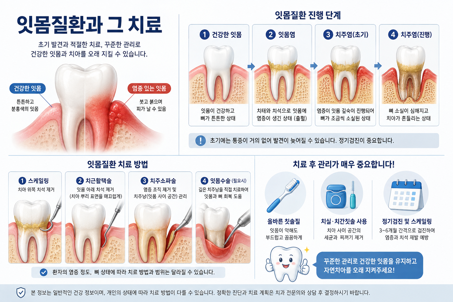 풍치의 원인과 치료법, 잇몸이 보내는 신호를 놓치지 마세요
