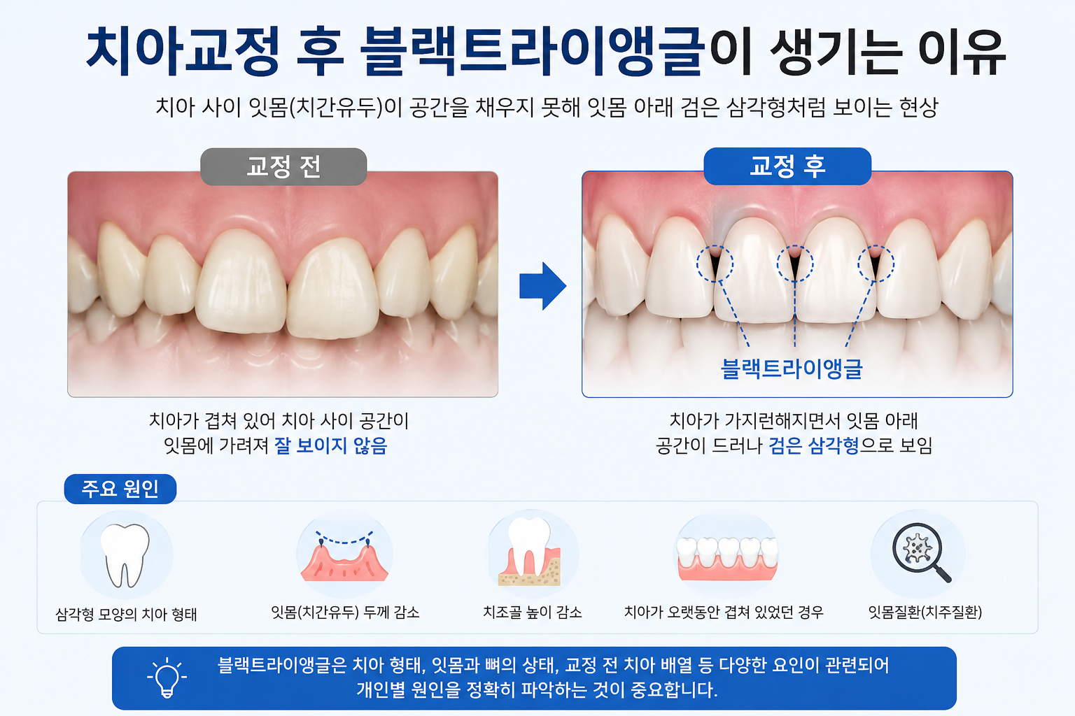 블랙 트라이앵글에 관한 설명