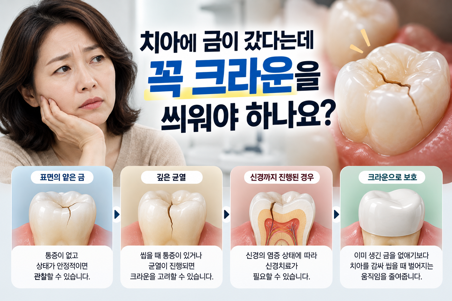 치아에 금이 갔다는데 꼭 크라운을 씌워야 하나요?